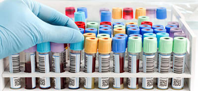 Etiquetas para laboratórios